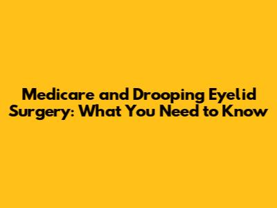 Medicare and Drooping Eyelid Surgery: What You Need to Know